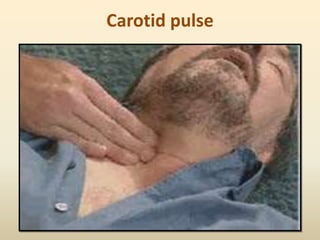 Carotid pulse
 