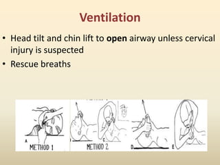 Ventilation
• Head tilt and chin lift to open airway unless cervical
injury is suspected
• Rescue breaths
 