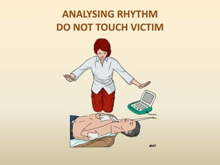 ANALYSING RHYTHM
DO NOT TOUCH VICTIM
 
