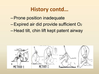 History contd…
–Prone position inadequate
–Expired air did provide sufficient O2
–Head tilt, chin lift kept patent airway
 
