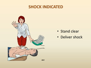 SHOCK INDICATED
• Stand clear
• Deliver shock
 