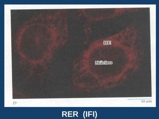 RER (IFI)
USMP-FMH-BCMH. LEZAMA 2015-II 9
 