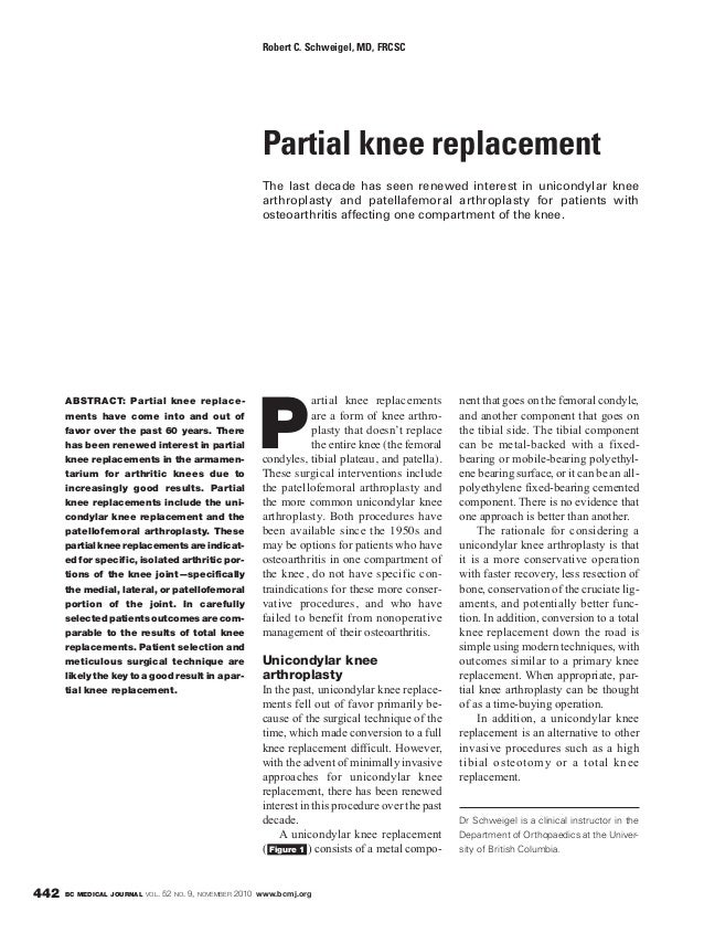 British Columbia Medical Journal November 2010 Knee replacement