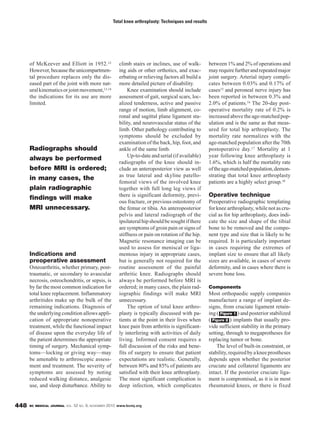 BC MEDICAL JOURNAL VOL. 52 NO. 9, NOVEMBER 2010 www.bcmj.org448
of McKeever and Elliott in 1952.12
However, because the unicompartmen-
tal procedure replaces only the dis-
eased part of the joint with more nat-
uralkinematicsorjointmovement,13,14
the indications for its use are more
limited.
Indications and
preoperative assessment
Osteoarthritis, whether primary, post-
traumatic, or secondary to avascular
necrosis, osteochondritis, or sepsis, is
by far the most common indication for
total knee replacement. Inflammatory
arthritides make up the bulk of the
remaining indications. Diagnosis of
the underlying condition allows appli-
cation of appropriate nonoperative
treatment, while the functional impact
of disease upon the everyday life of
the patient determines the appropriate
timing of surgery. Mechanical symp-
toms—locking or giving way—may
be amenable to arthroscopic assess-
ment and treatment. The severity of
symptoms are assessed by noting
reduced walking distance, analgesic
use, and sleep disturbance. Ability to
climb stairs or inclines, use of walk-
ing aids or other orthotics, and exac-
erbating or relieving factors all build a
more detailed picture of disability.
Knee examination should include
assessment of gait, surgical scars, loc-
alized tenderness, active and passive
range of motion, limb alignment, co-
ronal and sagittal plane ligament sta-
bility, and neurovascular status of the
limb. Other pathology contributing to
symptoms should be excluded by
examination of the back, hip, foot, and
ankle of the same limb.
Up-to-date and serial (if available)
radiographs of the knee should in-
clude an anteroposterior view as well
as true lateral and skyline patello-
femoral views of the involved knee
together with full long leg views if
there is significant deformity, previ-
ous fracture, or previous osteotomy of
the femur or tibia. An anteroposterior
pelvis and lateral radiograph of the
ipsilateralhipshouldbesoughtifthere
are symptoms of groin pain or signs of
stiffness or pain on rotation of the hip.
Magnetic resonance imaging can be
used to assess for meniscal or liga-
mentous injury in appropriate cases,
but is generally not required for the
routine assessment of the painful
arthritic knee. Radiographs should
always be performed before MRI is
ordered; in many cases, the plain rad-
iographic findings will make MRI
unnecessary.
The option of total knee arthro-
plasty is typically discussed with pa-
tients at the point in their lives when
knee pain from arthritis is significant-
ly interfering with activities of daily
living. Informed consent requires a
full discussion of the risks and bene-
fits of surgery to ensure that patient
expectations are realistic. Generally,
between 80% and 85% of patients are
satisfied with their knee arthroplasty.
The most significant complication is
deep infection, which complicates
between 1% and 2% of operations and
mayrequirefurtherandrepeatedmajor
joint surgery. Arterial injury compli-
cates between 0.03% and 0.17% of
cases15 and peroneal nerve injury has
been reported in between 0.3% and
2.0% of patients.16 The 20-day post-
operative mortality rate of 0.2% is
increased above the age-matched pop-
ulation and is the same as that meas-
ured for total hip arthroplasty. The
mortality rate normalizes with the
age-matched population after the 70th
postoperative day.17 Mortality at 1
year following knee arthroplasty is
1.6%, which is half the mortality rate
oftheage-matchedpopulation,demon-
strating that total knee arthroplasty
patients are a highly select group.18
Operative technique
Preoperative radiographic templating
for knee arthroplasty, while not as cru-
cial as for hip arthroplasty, does indi-
cate the size and shape of the tibial
bone to be removed and the compo-
nent type and size that is likely to be
required. It is particularly important
in cases requiring the extremes of
implant size to ensure that all likely
sizes are available, in cases of severe
deformity, and in cases where there is
severe bone loss.
Components
Most orthopaedic supply companies
manufacture a range of implant de-
signs, from cruciate ligament retain-
ing ( ) and posterior stabilized
( ) implants that usually pro-
vide sufficient stability in the primary
setting, through to megaprotheses for
replacing tumor or bone.
The level of built-in constraint, or
stability,requiredbyakneeprostheses
depends upon whether the posterior
cruciate and collateral ligaments are
intact. If the posterior cruciate liga-
ment is compromised, as it is in most
rheumatoid knees, or there is fixed
Figure 2
Figure 1
Total knee arthroplasty: Techniques and results
Radiographs should
always be performed
before MRI is ordered;
in many cases, the
plain radiographic
findings will make
MRI unnecessary.
 