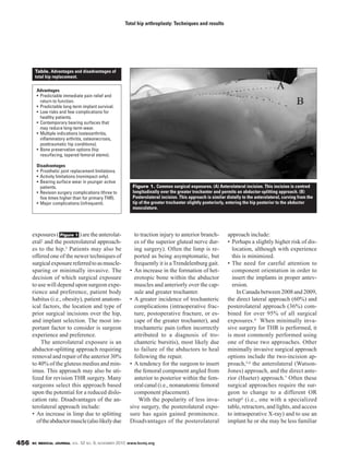 BC MEDICAL JOURNAL VOL. 52 NO. 9, NOVEMBER 2010 www.bcmj.org456
exposures ( ) are the anterolat-
eral2 and the posterolateral approach-
es to the hip.3 Patients may also be
offered one of the newer techniques of
surgicalexposurereferredtoasmuscle-
sparing or minimally invasive. The
decision of which surgical exposure
to use will depend upon surgeon expe-
rience and preference, patient body
habitus (i.e., obesity), patient anatom-
ical factors, the location and type of
prior surgical incisions over the hip,
and implant selection. The most im-
portant factor to consider is surgeon
experience and preference.
The anterolateral exposure is an
abductor-splitting approach requiring
removalandrepairoftheanterior30%
to 40% of the gluteus medius and min-
imus. This approach may also be uti-
lized for revision THR surgery. Many
surgeons select this approach based
upon the potential for a reduced dislo-
cation rate. Disadvantages of the an-
terolateral approach include:
• An increase in limp due to splitting
oftheabductormuscle(alsolikelydue
Figure 1 to traction injury to anterior branch-
es of the superior gluteal nerve dur-
ing surgery). Often the limp is re-
ported as being asymptomatic, but
frequently it is a Trendelenburg gait.
• An increase in the formation of het-
erotopic bone within the abductor
muscles and anteriorly over the cap-
sule and greater trochanter.
• A greater incidence of trochanteric
complications (intraoperative frac-
ture, postoperative fracture, or es-
cape of the greater trochanter), and
trochanteric pain (often incorrectly
attributed to a diagnosis of tro-
chanteric bursitis), most likely due
to failure of the abductors to heal
following the repair.
• A tendency for the surgeon to insert
the femoral component angled from
anterior to posterior within the fem-
oral canal (i.e., nonanatomic femoral
component placement).
With the popularity of less inva-
sive surgery, the posterolateral expo-
sure has again gained prominence.
Disadvantages of the posterolateral
approach include:
• Perhaps a slightly higher risk of dis-
location, although with experience
this is minimized.
• The need for careful attention to
component orientation in order to
insert the implants in proper antev-
ersion.
InCanadabetween2008and2009,
the direct lateral approach (60%) and
posterolateral approach (36%) com-
bined for over 95% of all surgical
exposures.4 When minimally inva-
sive surgery for THR is performed, it
is most commonly performed using
one of these two approaches. Other
minimally invasive surgical approach
options include the two-incision ap-
proach,5,6 the anterolateral (Watson-
Jones) approach, and the direct ante-
rior (Hueter) approach.7 Often these
surgical approaches require the sur-
geon to change to a different OR
setup6 (i.e., one with a specialized
table, retractors, and lights, and access
to intraoperative X-ray) and to use an
implant he or she may be less familiar
Total hip arthroplasty: Techniques and results
Advantages
• Predictable immediate pain relief and
return to function.
• Predictable long-term implant survival.
• Low risks and few complications for
healthy patients.
• Contemporary bearing surfaces that
may reduce long-term wear.
• Multiple indications (osteoarthritis,
inflammatory arthritis, osteonecrosis,
posttraumatic hip conditions).
• Bone preservation options (hip
resurfacing, tapered femoral stems).
Disadvantages
• Prosthetic joint replacement limitations.
• Activity limitations (nonimpact only).
• Bearing surface wear in younger active
patients.
• Revision surgery complications (three to
five times higher than for primary THR).
• Major complications (infrequent).
Table. Advantages and disadvantages of
total hip replacement.
Figure 1. Common surgical exposures. (A) Anterolateral incision. This incision is centred
longitudinally over the greater trochanter and permits an abductor-splitting approach. (B)
Posterolateral incision. This approach is similar distally to the anterolateral, curving from the
tip of the greater trochanter slightly posteriorly, entering the hip posterior to the abductor
musculature.
 