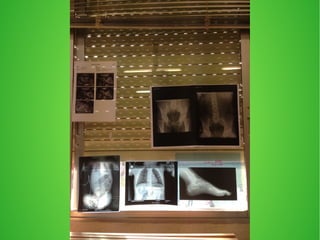 crani  i radiografies