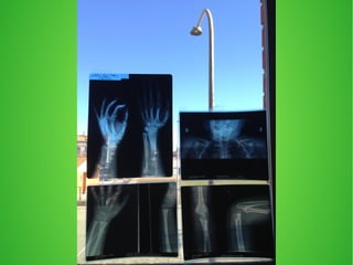 crani  i radiografies