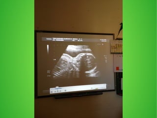 crani  i radiografies