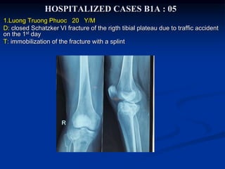 HOSPITALIZED CASES B1A : 05
1.Luong Truong Phuoc 20 Y/M
D: closed Schatzker VI fracture of the rigth tibial plateau due to traffic accident
on the 1st day
T: immobilization of the fracture with a splint
 