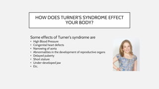 Turner syndrome | PPT