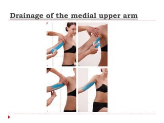 Drainage of the medial upper arm
 