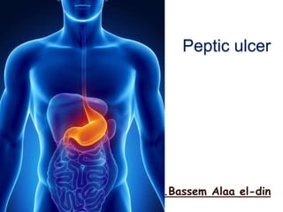 Peptic ulcer
By Dr.Bassem Alaa el-din
 