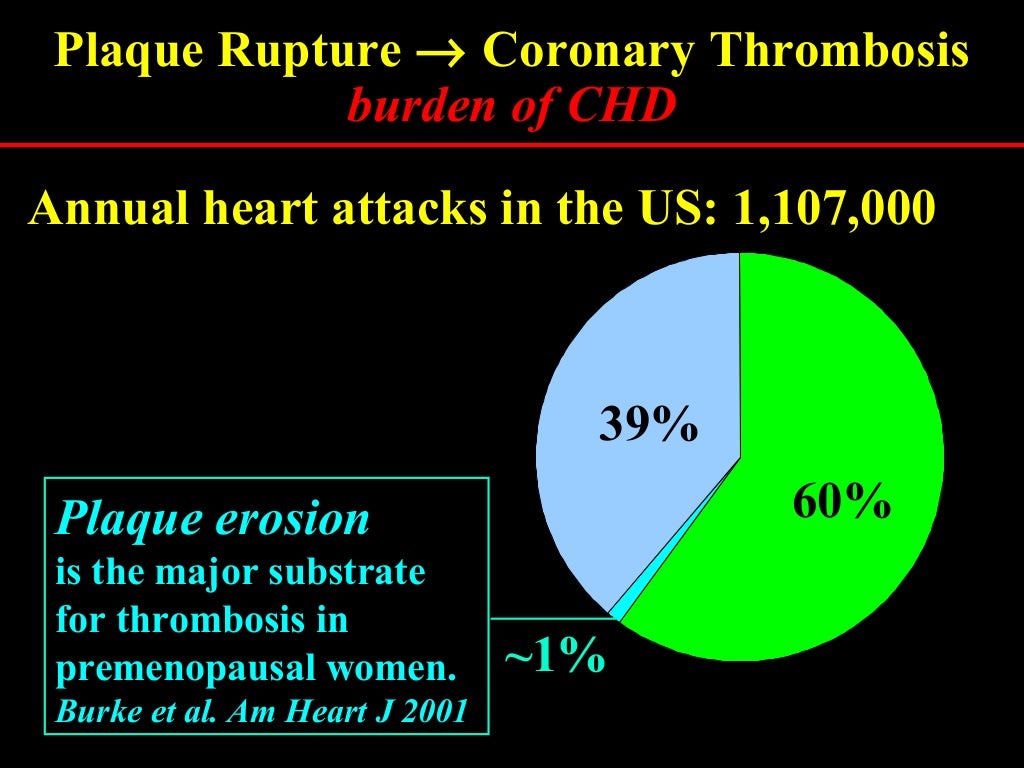 Plaque rupture definition