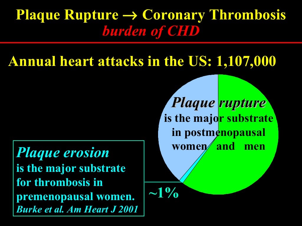 Plaque rupture definition