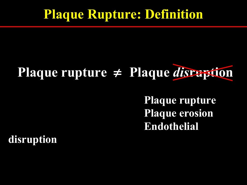 Plaque rupture definition