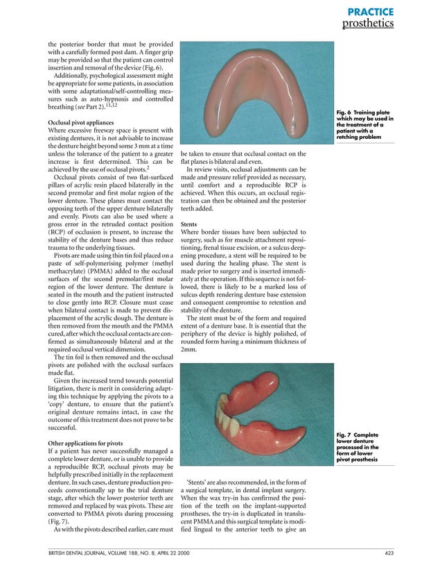 Bdj complete denture PDF