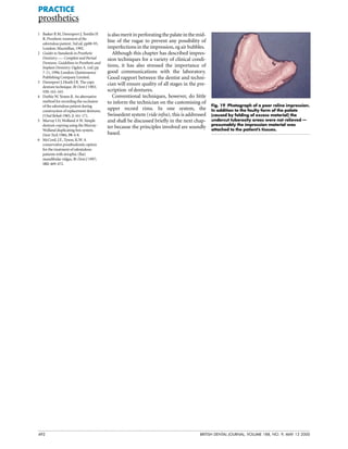 492 BRITISH DENTAL JOURNAL, VOLUME 188, NO. 9, MAY 13 2000
PRACTICE
prosthetics
isalsomeritinperforatingthepalateinthemid-
line of the rugae to prevent any possibility of
imperfections in the impression, eg air bubbles.
Although this chapter has described impres-
sion techniques for a variety of clinical condi-
tions, it has also stressed the importance of
good communications with the laboratory.
Good rapport between the dentist and techni-
cian will ensure quality of all stages in the pre-
scription of dentures.
Conventional techniques, however, do little
to inform the technician on the customising of
upper record rims. In one system, the
Swissedent system (vide infra), this is addressed
and shall be discussed briefly in the next chap-
ter because the principles involved are soundly
based.
Fig. 19 Photograph of a poor reline impression.
In addition to the faulty form of the palate
(caused by folding of excess material) the
undercut tuberosity areas were not relieved —
presumably the impression material was
attached to the patient’s tissues.
1 Basker R M, Davenport J, Tomlin H
R. Prosthetic treatment of the
edentulous patient. 3rd ed. pp88-93,
London: Macmillan, 1992.
2 Guides to Standards in Prosthetic
Dentistry —- Complete and Partial
Dentures. Guidelines in Prosthetic and
Implant Dentistry. Ogden A. (ed) pp
7-11, 1996; London: Quintessence
Publishing Company Limited.
3 Davenport J, Heath J R. The copy
denture technique. Br Dent J 1983;
155: 162-163.
4 Duthie W, Yemm R. An alternative
method for recording the occlusion
of the edentulous patient during
construction of replacement dentures.
J Oral Rehab 1985; 2: 161-171.
5 Murray I D, Wolland A W. Simple
denture copying using the Murray-
Wolland duplicating box system.
Dent Tech 1986; 39: 4-8.
6 McCord, J.F., Tyson, K.W. A
conservative prosthodontic option
for the treatment of edentulous
patients with atrophic (flat)
mandibular ridges. Br Dent J 1997;
182: 469-472.
 
