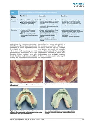 Bdj complete denture