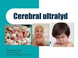 Cerebral ultralyd
Ultralydkurs 2023
Sebastian Abel-Grüner
overlege v/barneradiologisk seksjon SoHo
 