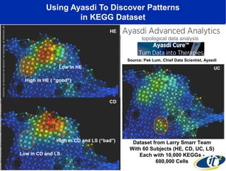 Using Ayasdi To Discover Patterns 
in KEGG Dataset 
topological data analysis 
Source: Pek Lum, Chief Data Scientist, Ayasdi 
Dataset from Larry Smarr Team 
With 60 Subjects (HE, CD, UC, LS) 
Each with 10,000 KEGGs - 
600,000 Cells 
 