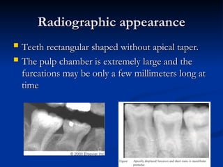 Restangular Shape Teeth BDS 2025 Abnormalities of teeth of teeth.ppt