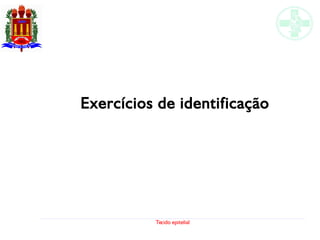 Tecido epitelial
Exercícios de identificação
 