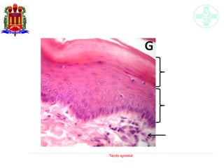 Tecido epitelial
 