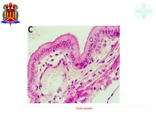 Tecido epitelial
 