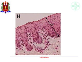 Tecido epitelial
 