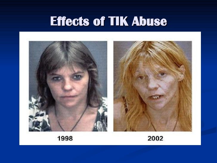 no web crack back meth no web crack back meth