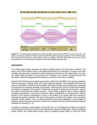 Figure 9: The Gold signal represents the output 20 MHz signal from the DPSK circuit to the coils. The
Green is the same signal from Figure 6 and is the DPSK signal to change the phase of the 20 MHz signal.
The Purple and Pink signals on the bottom are the coil signals. With this information we can see correct
data transmission and a strong transmission connection between the data coils.
DISCUSSION
The uWalk Again design advances the field of epidural spinal cord stimulation research. The
layout of the GUI has been shown to be logical and intuitive in its operation. It is also much more
versatile and ergonomic compared to other programming devices on the market today. As such,
the uWalk Again will allow for and promote an increase in the volume of epidural spinal cord
stimulation research being performed simply as a result of its increase in usability.
Figures 8 and 9 show the successful transmission of data from the MCU to the implant wirelessly.
This is a key step in making spinal cord injury treatment plausible. This capability minimizes the
amount of hardware implanted into the patient while still including those components necessary
to accomplish the required versatility of stimulation. Reducing the amount of implanted hardware
promotes the longevity of the system. Furthermore, because of wireless communication, most of
the system components lie outside the body - which makes it easy to add or remove different
hardware components in the future to allow for system simplification or enhancement. Another
benefit of this external motherboard is seen in the ability to do simple tasks like change or
recharge the systems batteries. We have further reason to believe this system to be successful
because similar systems such as retinal prosthetics have also capitalized on the benefits of
wireless communication to control the implant from outside the body and demonstrated effective
treatment or therapy [16, 17].
In addition to wireless communication, the results from our coil dislocation studies are indicative
of successful future function of power and data transfer using the uWalk Again. When considering
power transfer, the implant-side circuitry must be supplied enough power to control all circuit
 