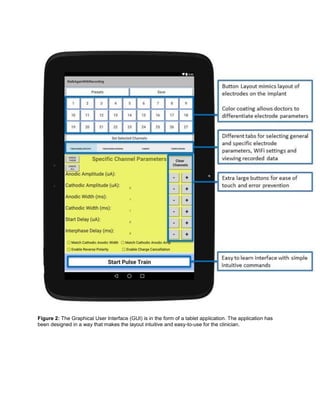 Figure 2: The Graphical User Interface (GUI) is in the form of a tablet application. The application has
been designed in a way that makes the layout intuitive and easy-to-use for the clinician.
 