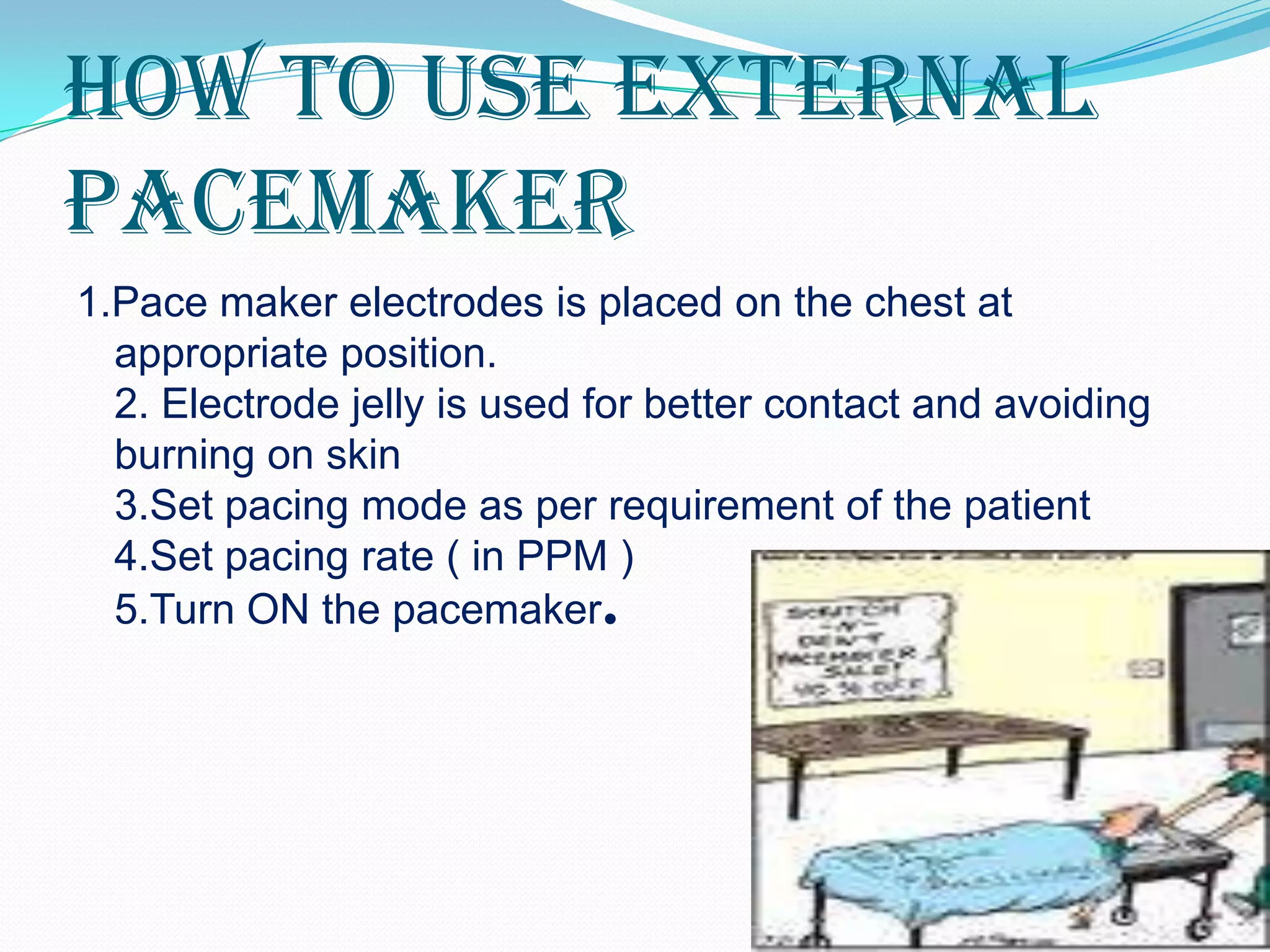 How to use external
pacemaker
1.Pace maker electrodes is placed on the chest at
  appropriate position.
  2. Electrode jelly is used for better contact and avoiding
  burning on skin
  3.Set pacing mode as per requirement of the patient
  4.Set pacing rate ( in PPM )
  5.Turn ON the pacemaker.
 