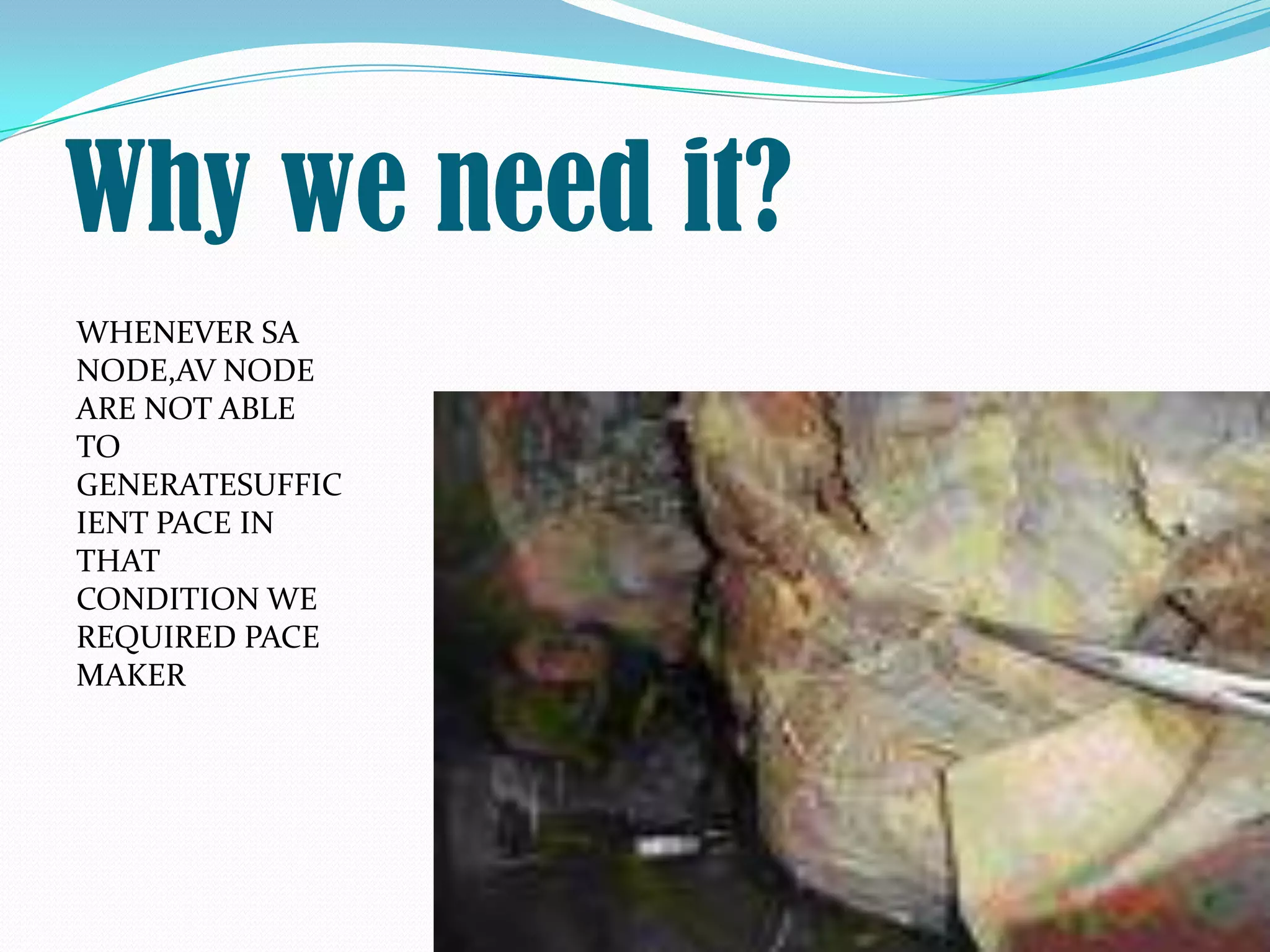 Why we need it?
WHENEVER SA
NODE,AV NODE
ARE NOT ABLE
TO
GENERATESUFFIC
IENT PACE IN
THAT
CONDITION WE
REQUIRED PACE
MAKER
 