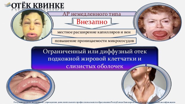 Болезнь фара клинические рекомендации