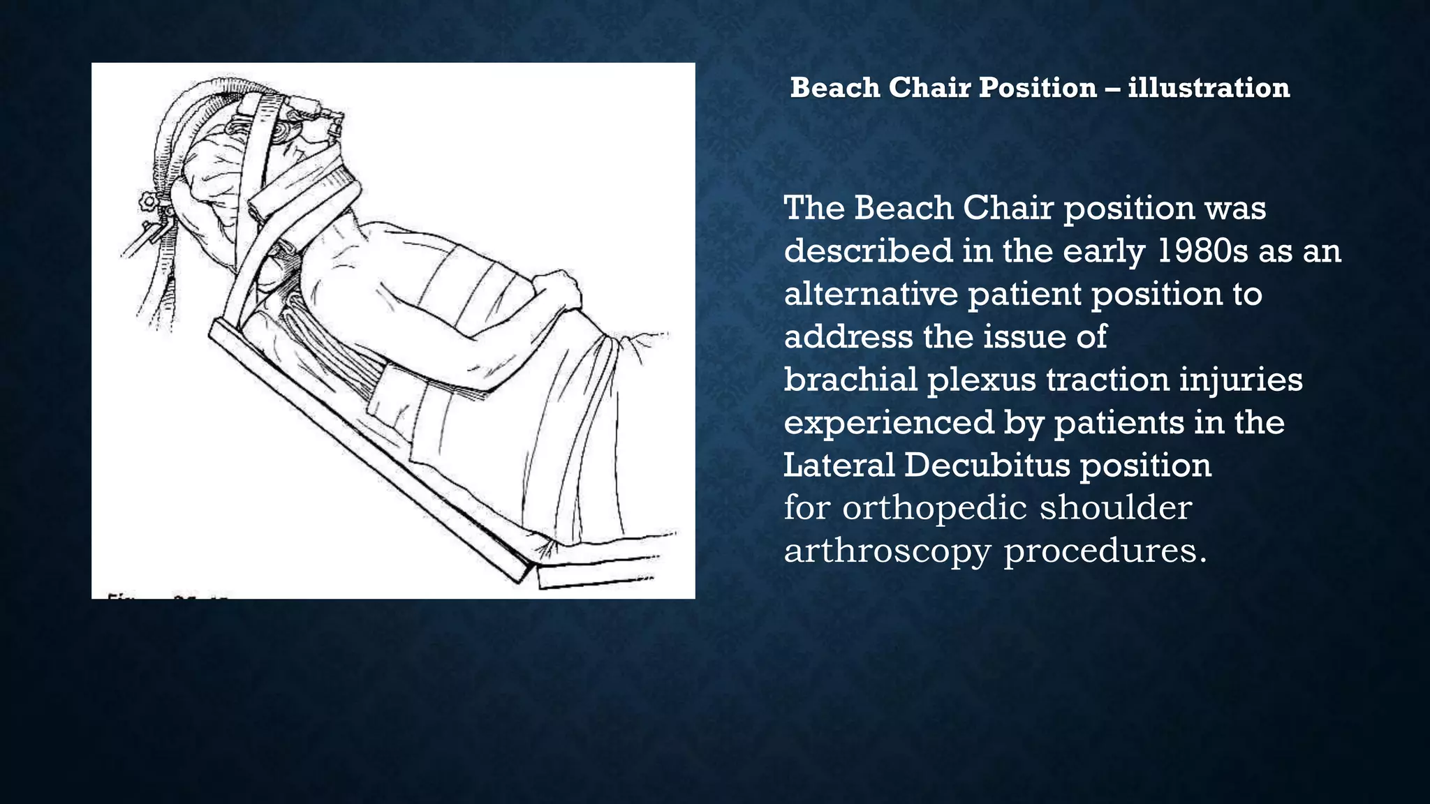 Beach chair position  a short introduction