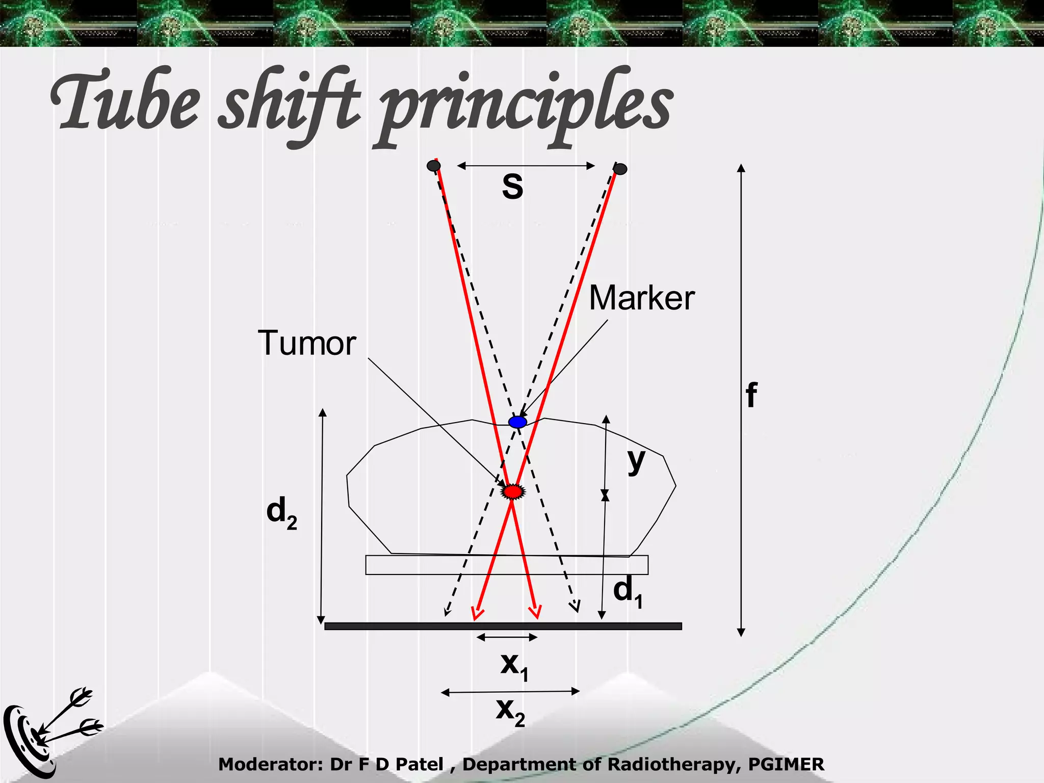 Tube shift principles Marker d 2 y f S Tumor x 1 x 2 d 1 