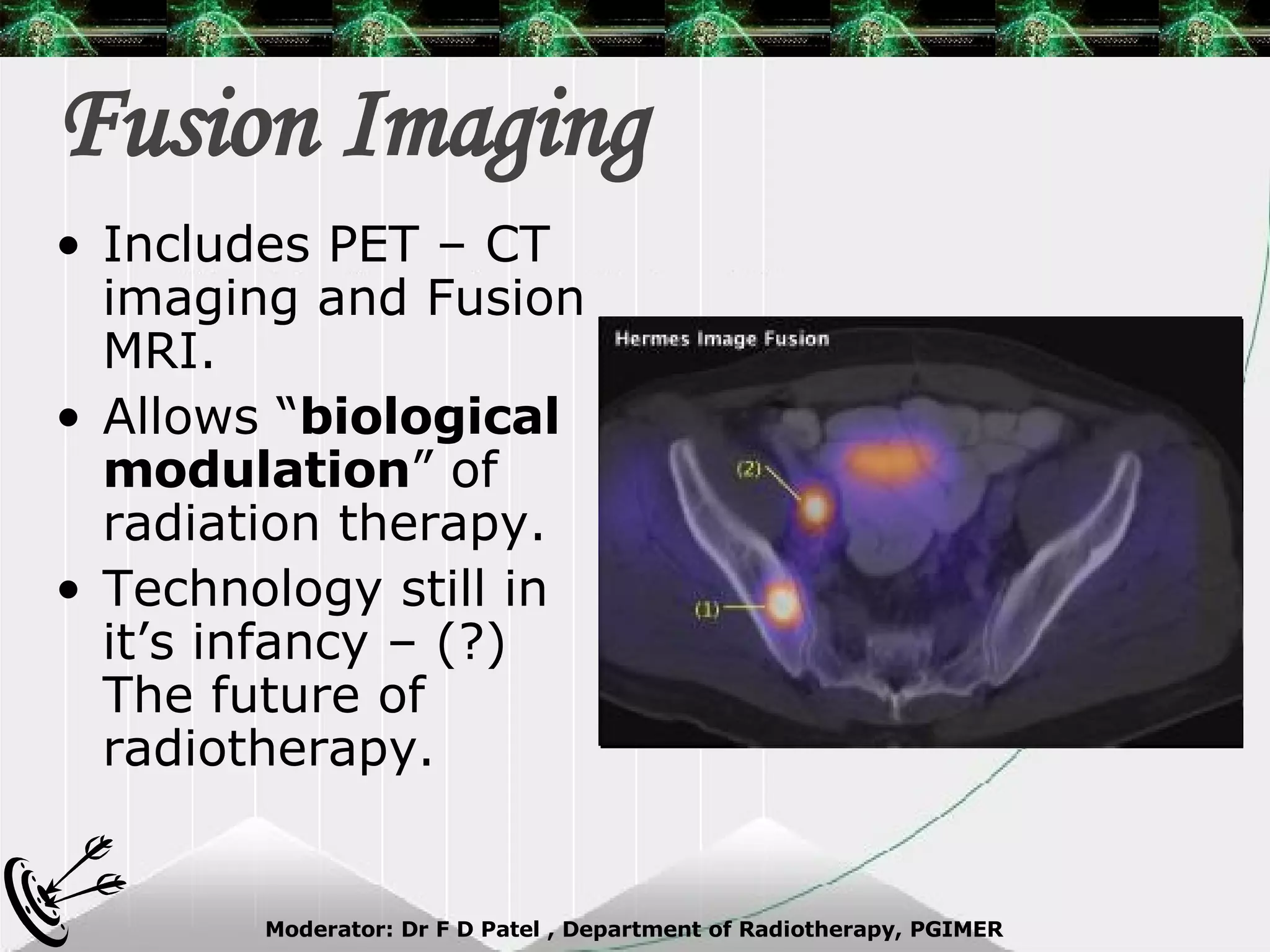 Fusion Imaging Includes PET – CT imaging and Fusion MRI. Allows “ biological modulation ” of radiation therapy. Technology still in it’s infancy – (?) The future of radiotherapy. 