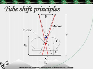 Tube shift principles Marker d 2 y f S Tumor x 1 x 2 d 1 