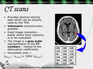 CT scans Provides electron density data which can be directly used by the TPS. Volumetric  reconstruction possible. Good image resolution - better where bony anatomy is to be evaluated. The image is a  gray scale  representation of the  CT numbers  – related to the attenuation coefficients. Hounsfield units =  ( μ tissue  –  μ water ) x 1000/ ( μ water ) 598 123 36 65 300 269 247 158 135 156 450 56 112 125 125 235 265 253 