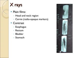 X rays Plain films: Head and neck region Cervix (radio-opaque markers) Contrast Esophagus Rectum Bladder Stomach 