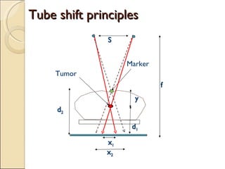 Tube shift principles Marker d 2 y f S Tumor x 1 x 2 d 1 