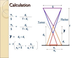 Calculation d 1 f y d 2 x 1 x 2 x 1 S = d 1 f – d 1 S x 2 S = d 2 f – d 2 y = d 2  – d 1 = f x 2   +  S x 2 - x 1   +  S x 1 Tumor Marker 