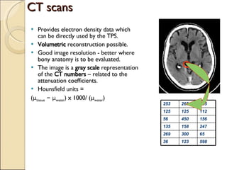 CT scans Provides electron density data which can be directly used by the TPS. Volumetric  reconstruction possible. Good image resolution - better where bony anatomy is to be evaluated. The image is a  gray scale  representation of the  CT numbers  – related to the attenuation coefficients. Hounsfield units =  ( μ tissue   –   μ water ) x 1000/ ( μ water ) 253 265 235 125 125 112 56 450 156 135 158 247 269 300 65 36 123 598 