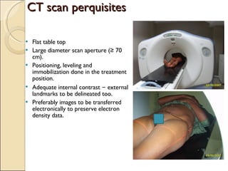 CT scan perquisites Flat table top  Large diameter scan aperture (≥ 70 cm). Positioning, leveling and immobilization done in the treatment position. Adequate internal contrast  –  external landmarks to be delineated too. Preferably images to be transferred electronically to preserve electron density data. 
