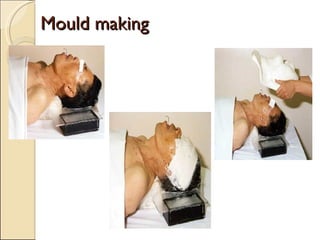 Mould making 