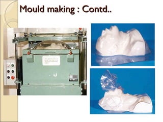 Mould making : Contd.. 