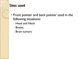 Sites used Front pointer and back pointer used in the following situations: Head and Neck Breast Brain tumors 