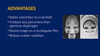 ADVANTAGES
• Better restriction to x-ray field
• Produce less penumbra than
aperture diaphragm
• Round image on a rectangular film
• Reduce scatter radiation
 