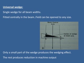 Universal wedge:
Single wedge for all beam widths.
Fitted centrally in the beam..Field can be opened to any size.
Only a small part of the wedge produces the wedging effect.
The rest produces reduction in machine output
 